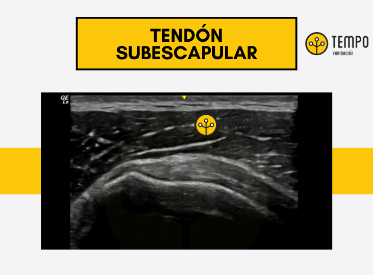 tendon-subescapular-aprende-a-valorarlo